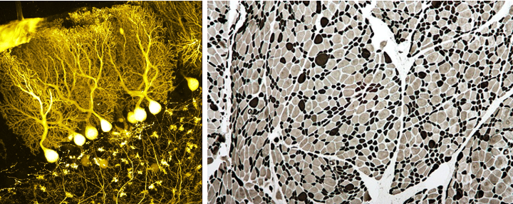 Brain (left) and muscle cells (right) (Wikipedia: BrainsRusDC, left and Nephron, right).